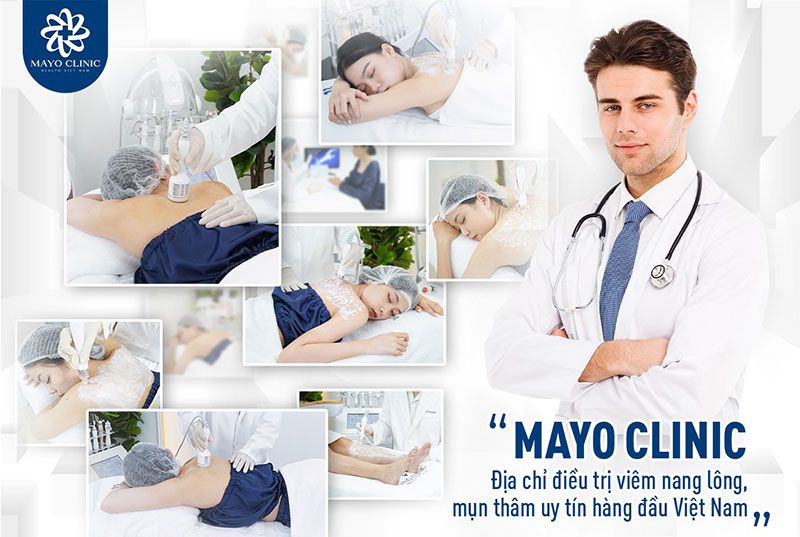 Mayo Clinic - Top 1 điều trị viêm nang lông, viêm da bằng công nghệ cao tại Việt Nam - Cộng Đồng Mạng